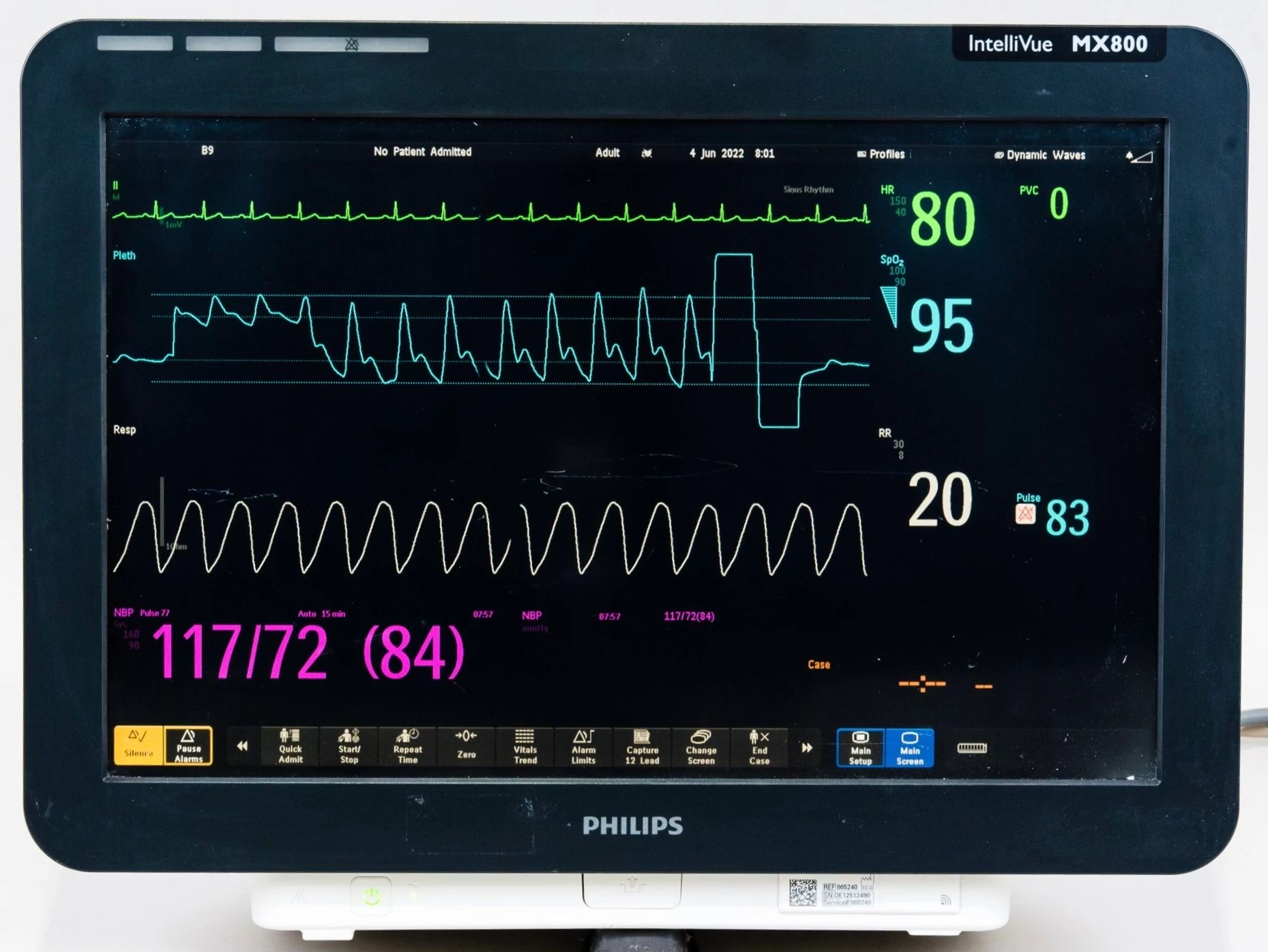 Philips Intellivue MX800 Anesthesia CO2 Monitor With M3001A & 867041 Modules - Image 2