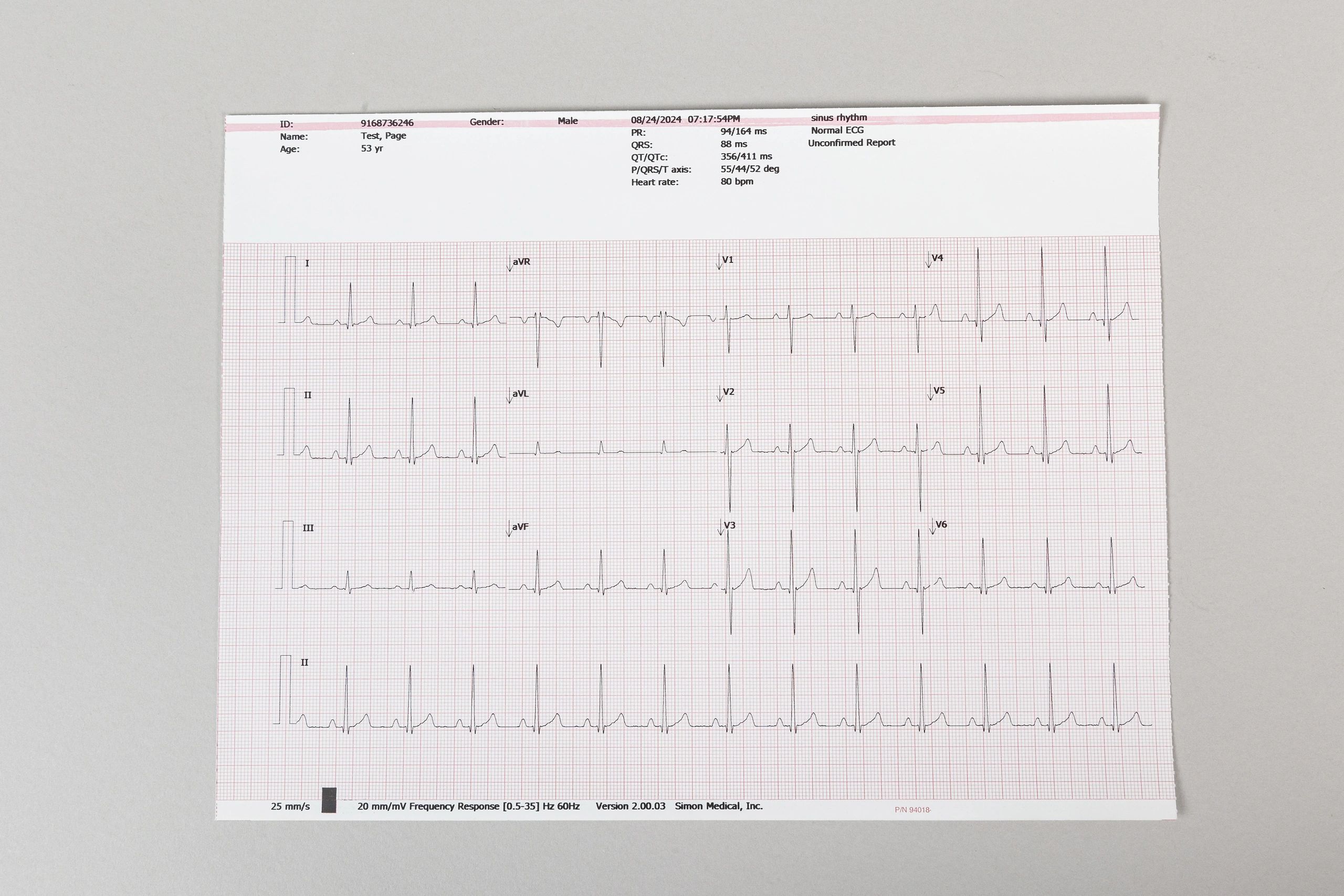 Welch Allyn CP150 Interpretation EKG ECG Electrocardiograph With Leads And Spirometer Module - Image 10