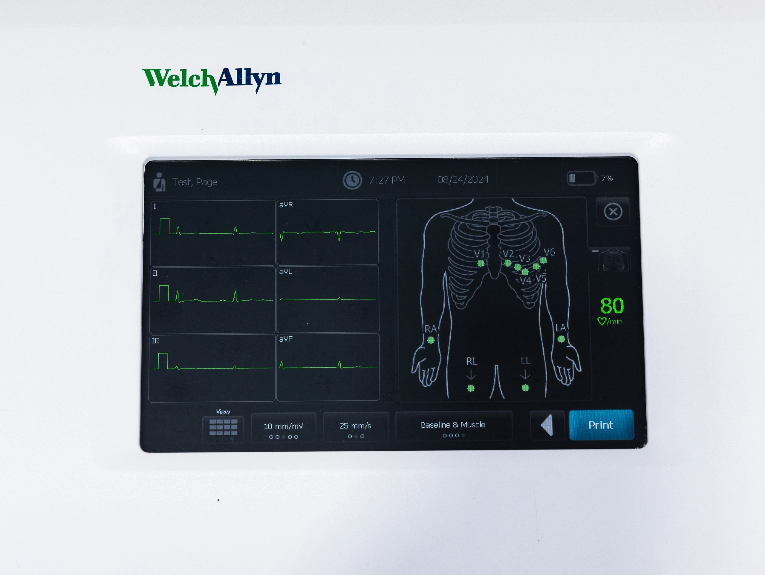 Welch Allyn CP150 Interpretation EKG ECG Electrocardiograph With Leads And Spirometer Module - Image 3