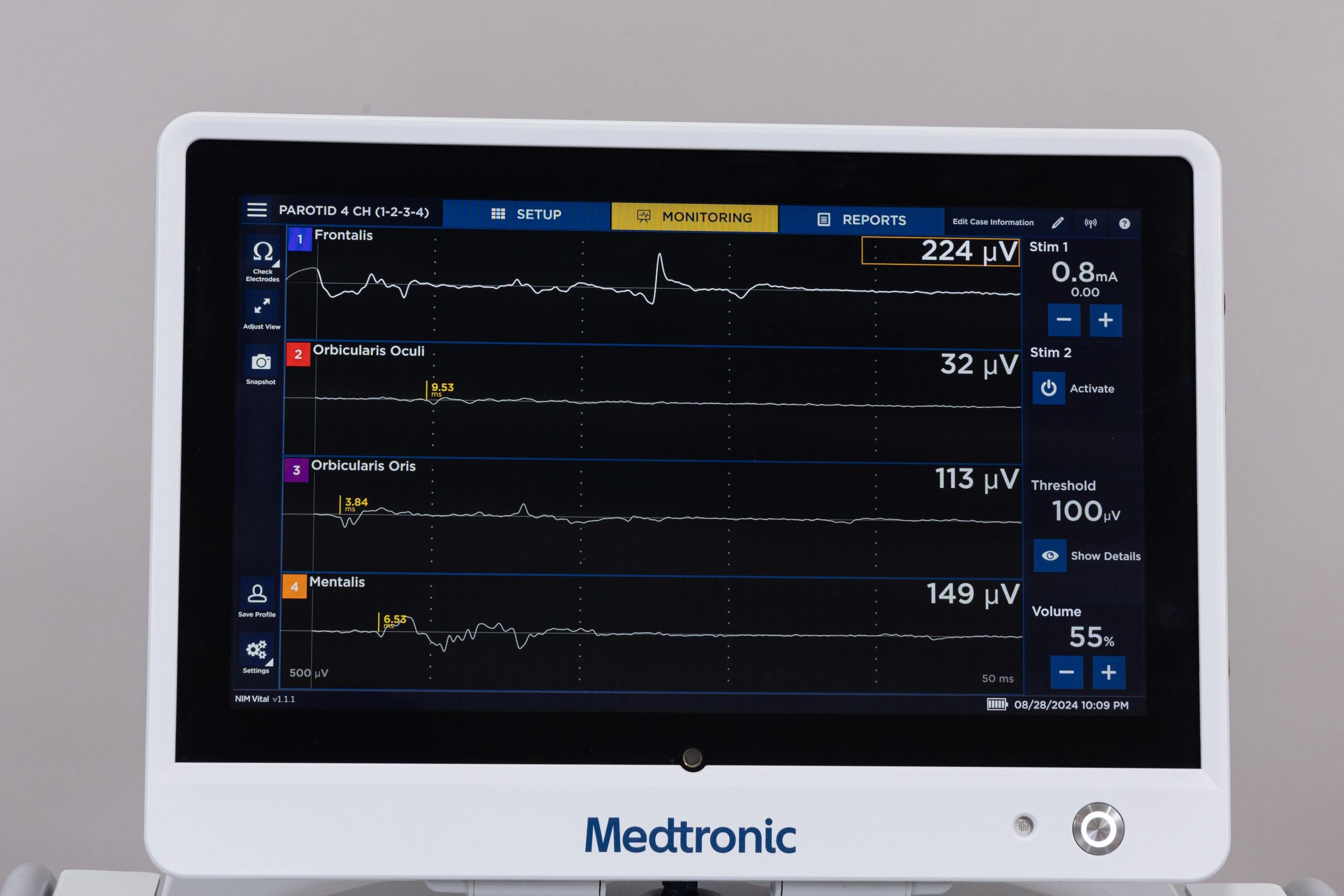 Medtronic NIM Vital Nerve Monitoring System with Patient Interfaces and Cart - Image 5