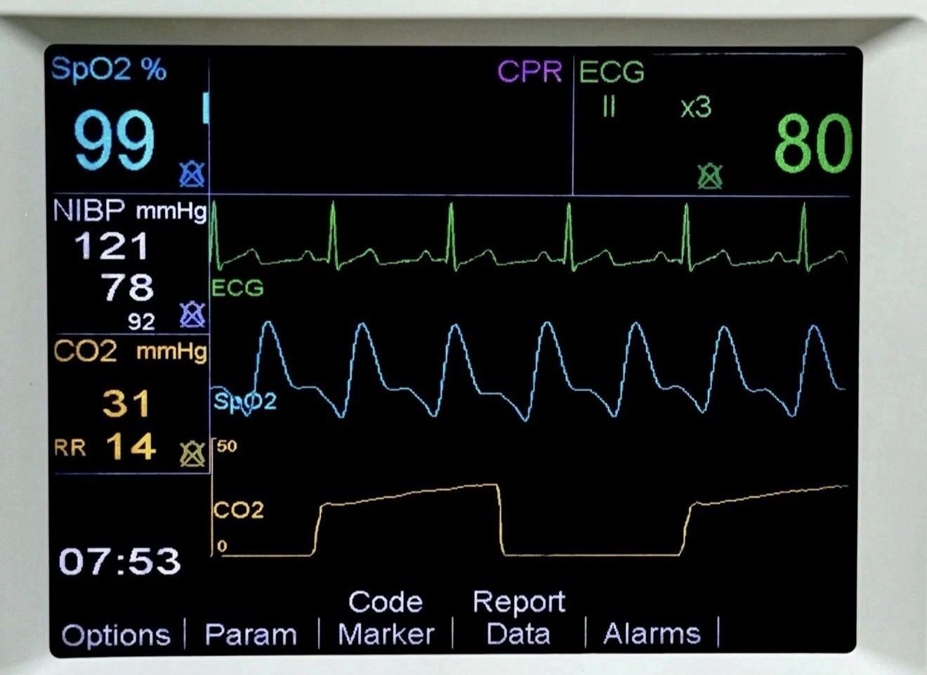 Zoll R Series ALS Monitor With ECG, Masimo SPO2, CO2, NIBP, MFC, Pacing, Printer, Paddles, And Battery - Image 2