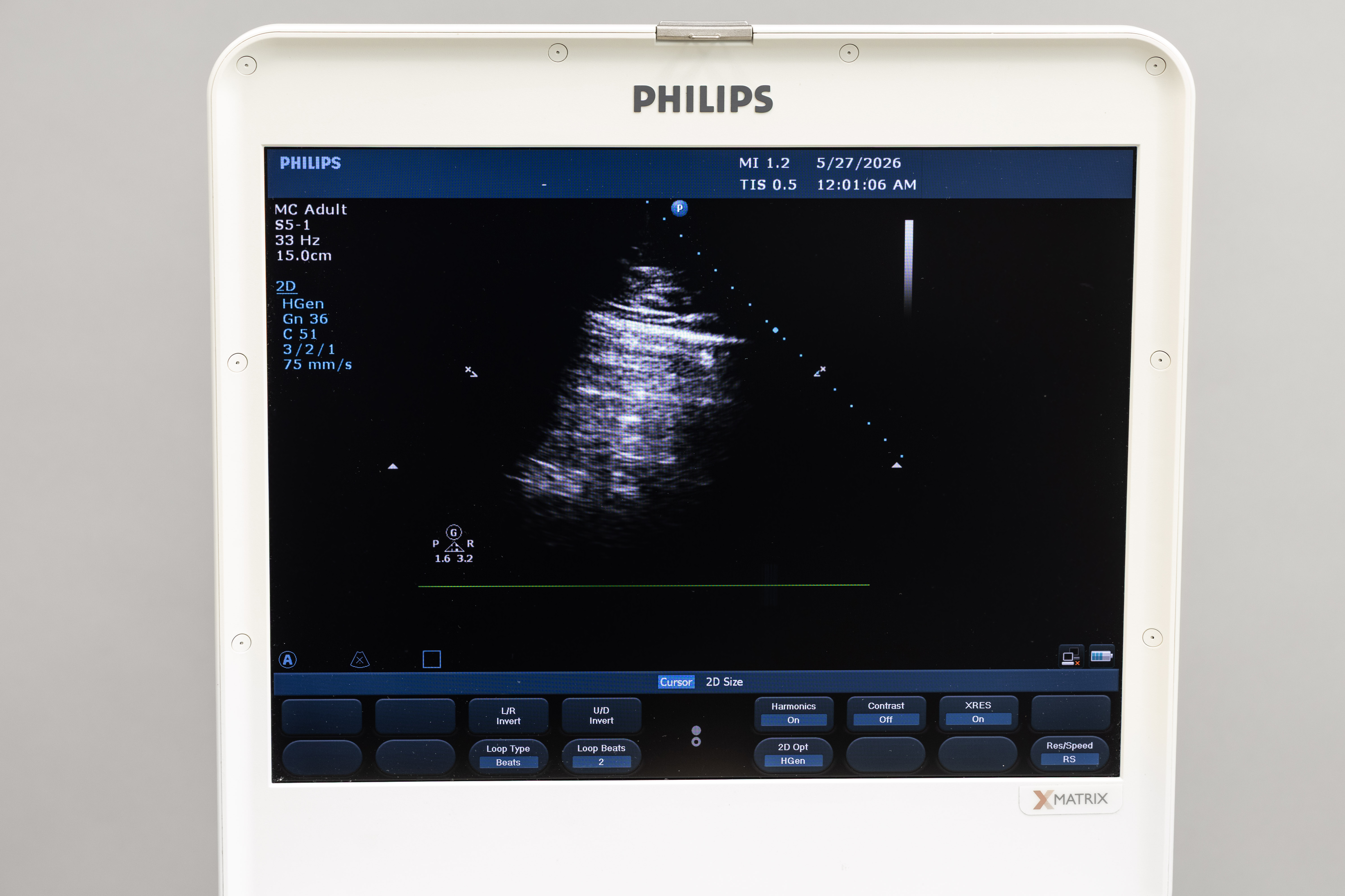 Philips CX50 Diagnostic Ultrasound System With AC Adapter - Image 5