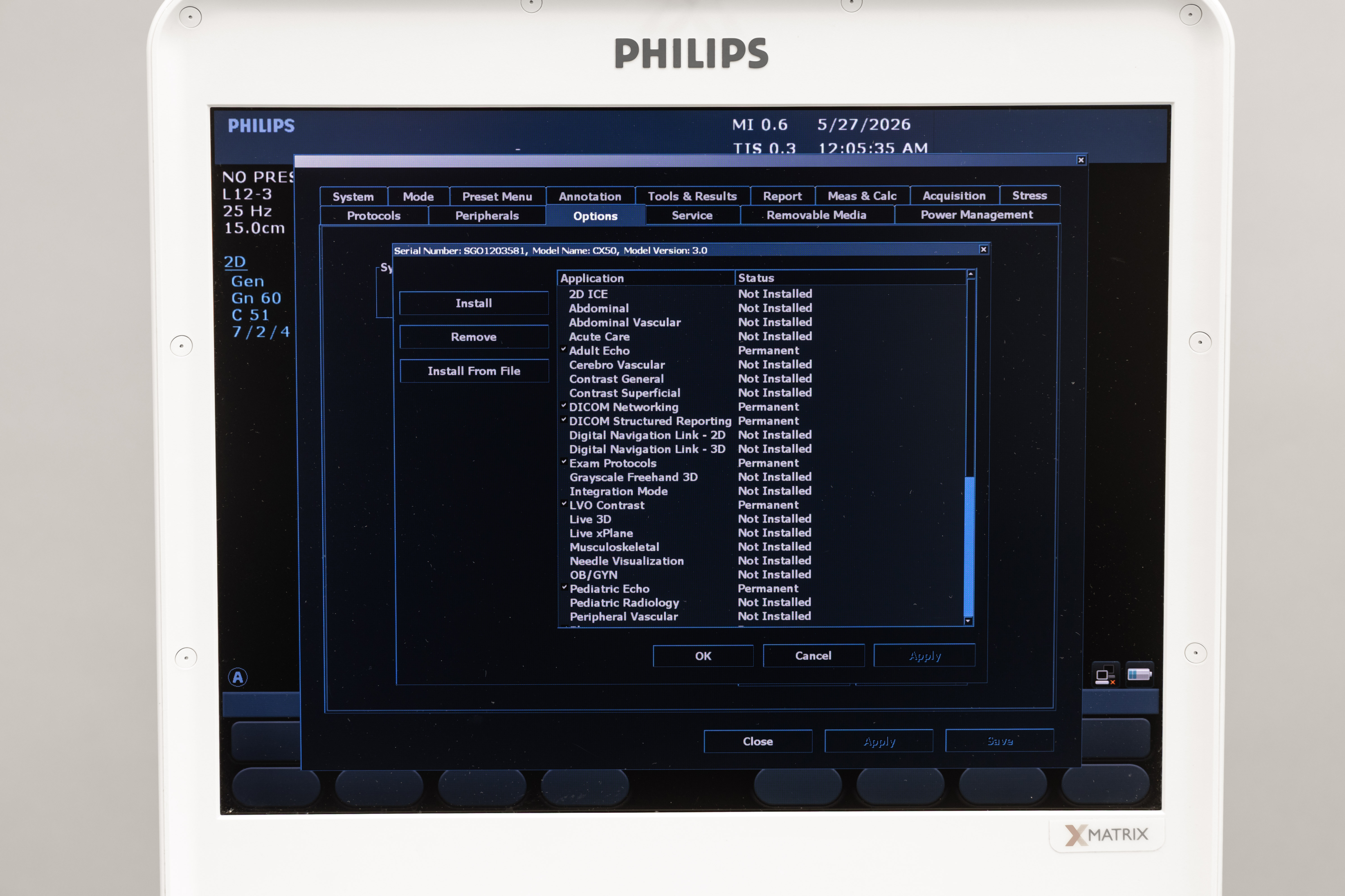 Philips CX50 Diagnostic Ultrasound System With AC Adapter - Image 2
