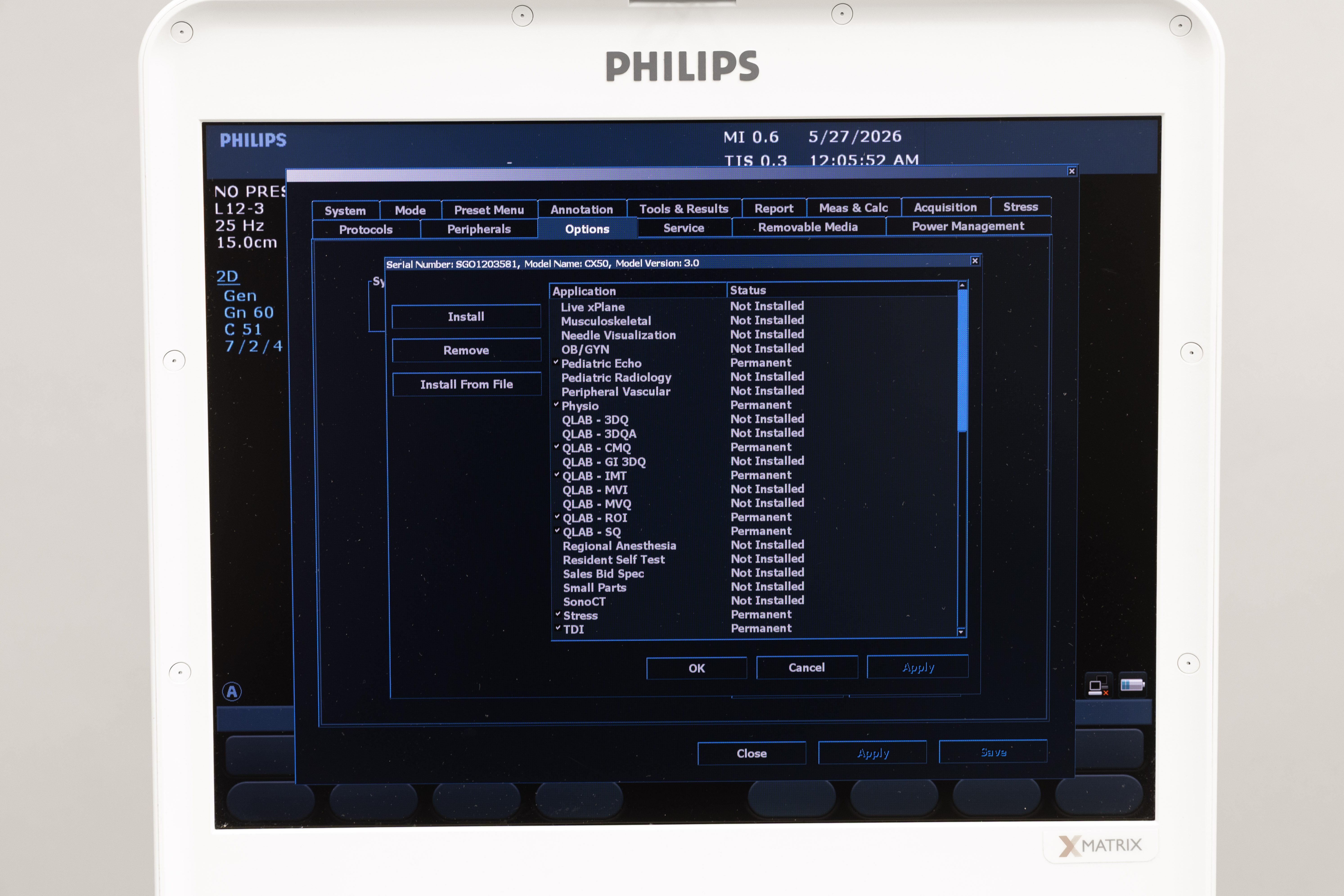 Philips CX50 Diagnostic Ultrasound System With AC Adapter - Image 3