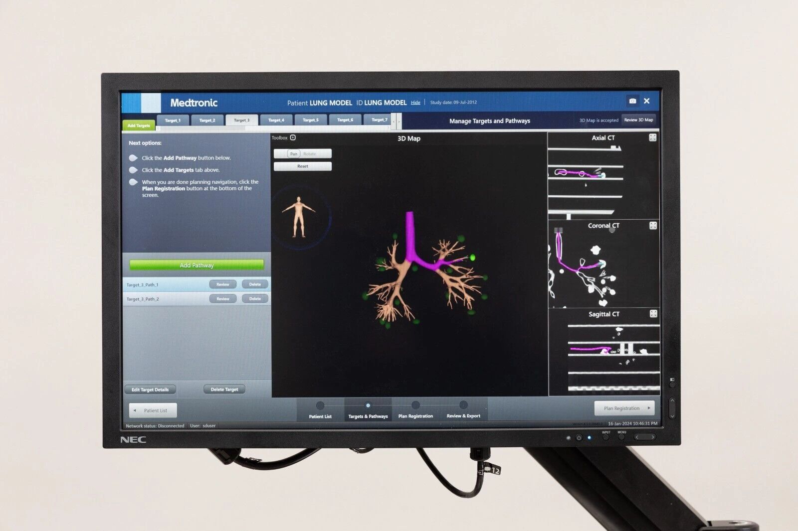 Medtronic ILLUMISITE Fluoroscopic Navigation System - Image 2