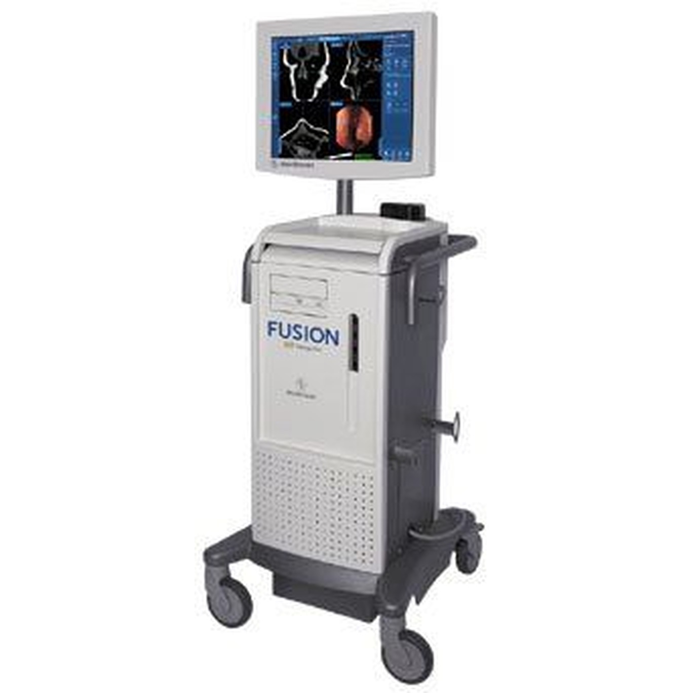 Medtronic Fusion ENT Navigation Complete System – Refurbished