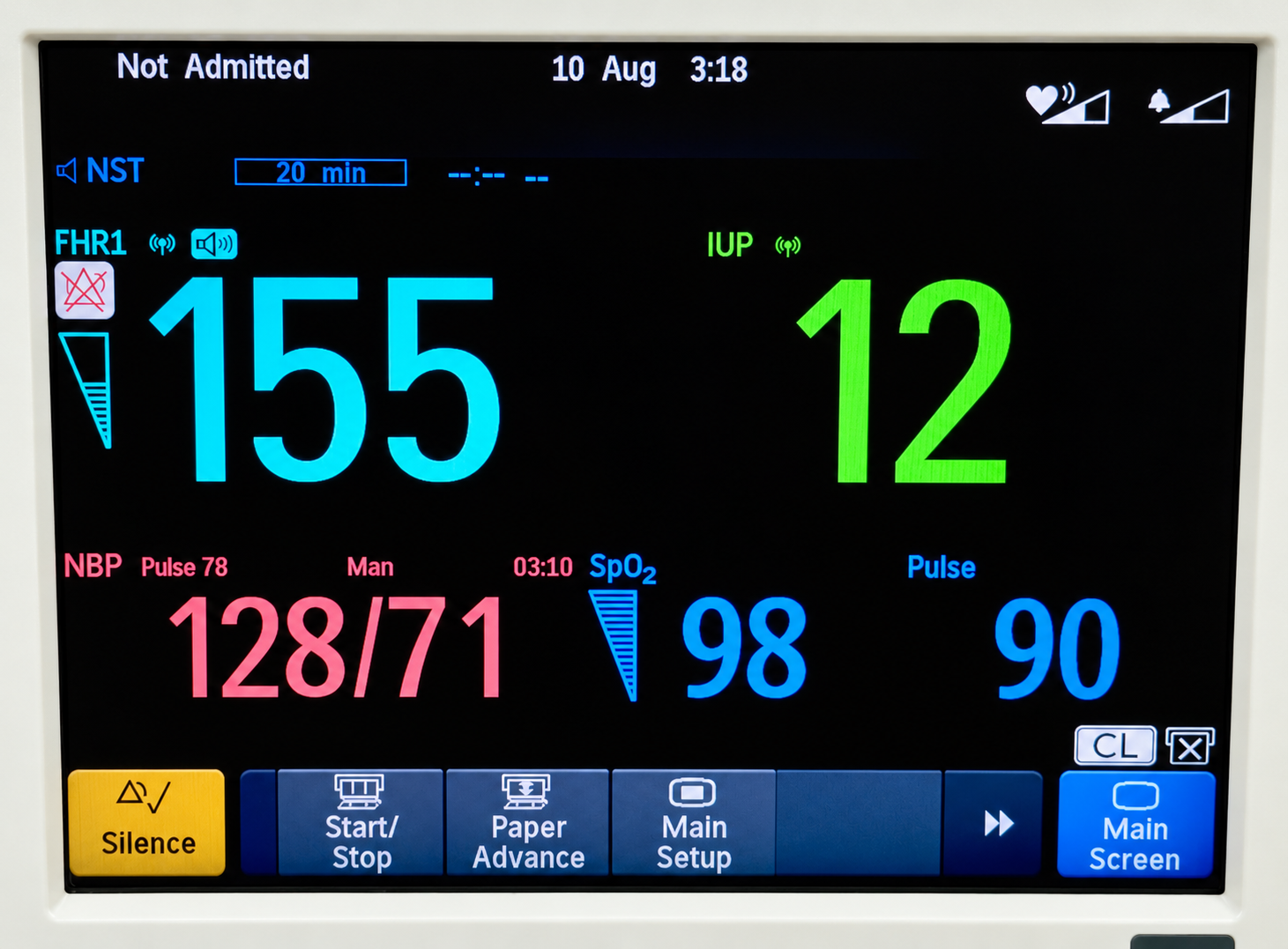 Philips Avalon FM50 Fetal Monitor With Avalon CL Wireless Set - Image 3